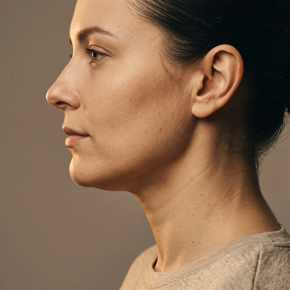 Zabieg lipolizy iniekcyjnej — profil twarzy, linia szczęki i podbródek